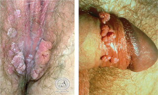 Illustration for article titled obat kutil alami di jual di apotek